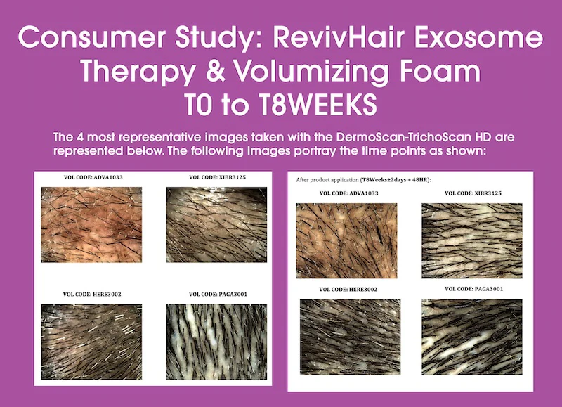 RevivHair Exosome Therapy & Volumizing Foam - Image 5