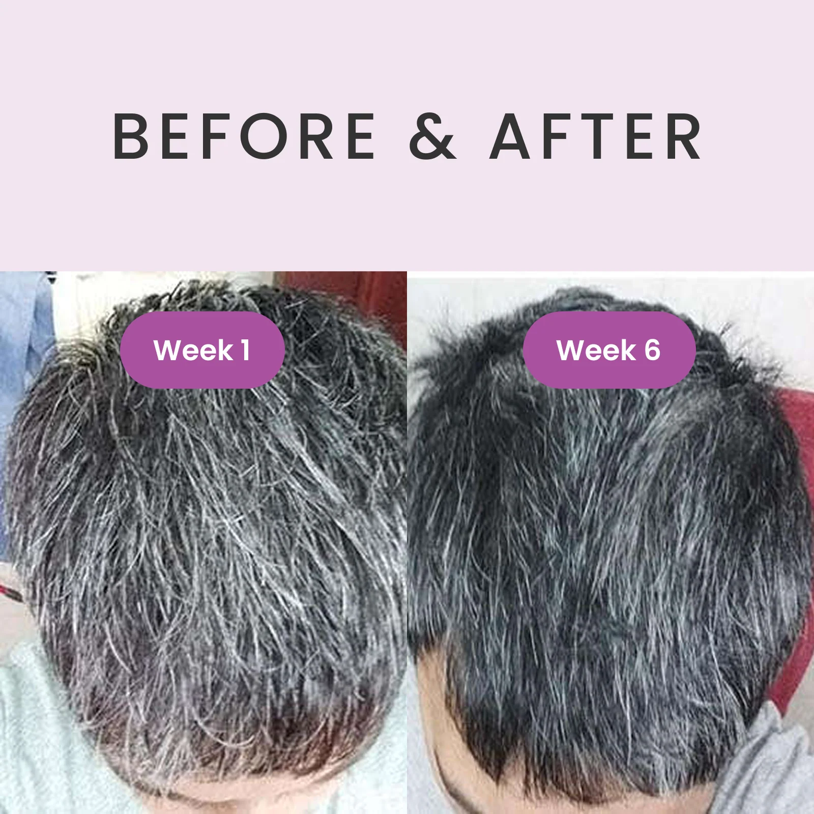 RevivHair REV Advanced: Grey Hair Reverse Serum with MelanoGray & Greyverse - Image 4