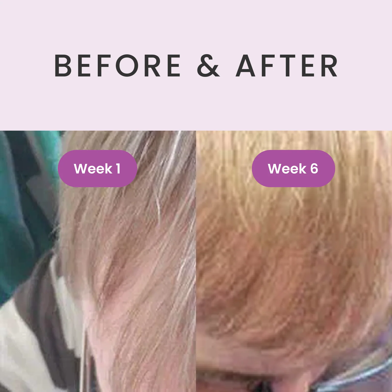 RevivHair REV Advanced: Grey Hair Reverse Serum with MelanoGray & Greyverse - Image 5