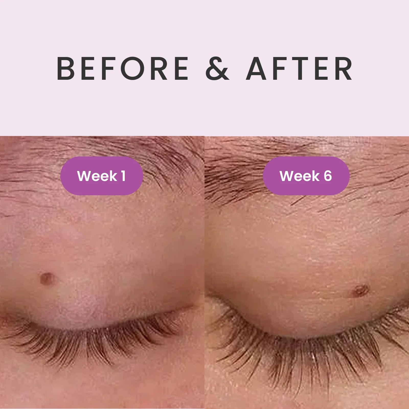 RevivLash Lash & Brow Stimulating Serum - Image 4