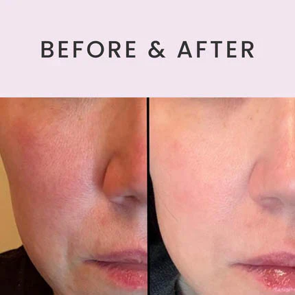 Ultimate Serum with Exosomes, Growth Factors & Peptides - Image 5